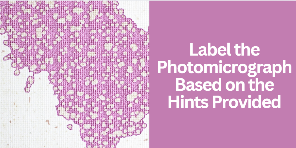 Label the Photomicrograph Based on the Hints Provided